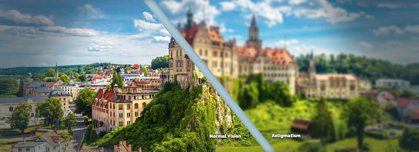 Astigmatism Treatment in Northside