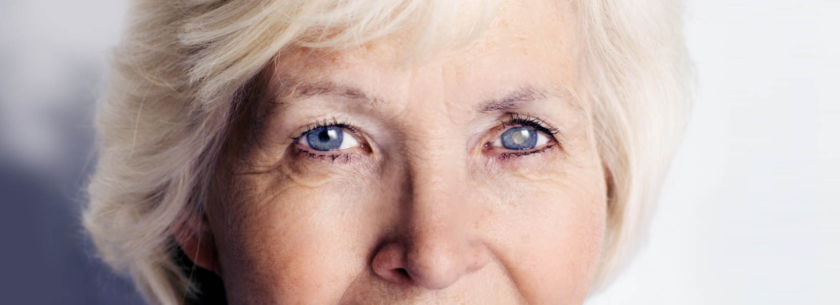 Cataract Surgery in Northside